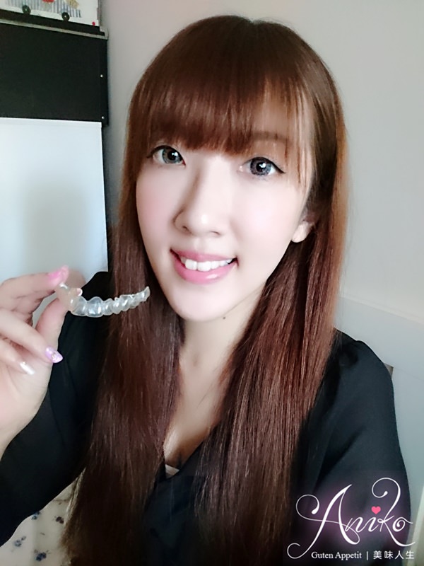 【保養】隱適美 Invisalign。矯正牙齒也能這麼低調！1個月心得分享