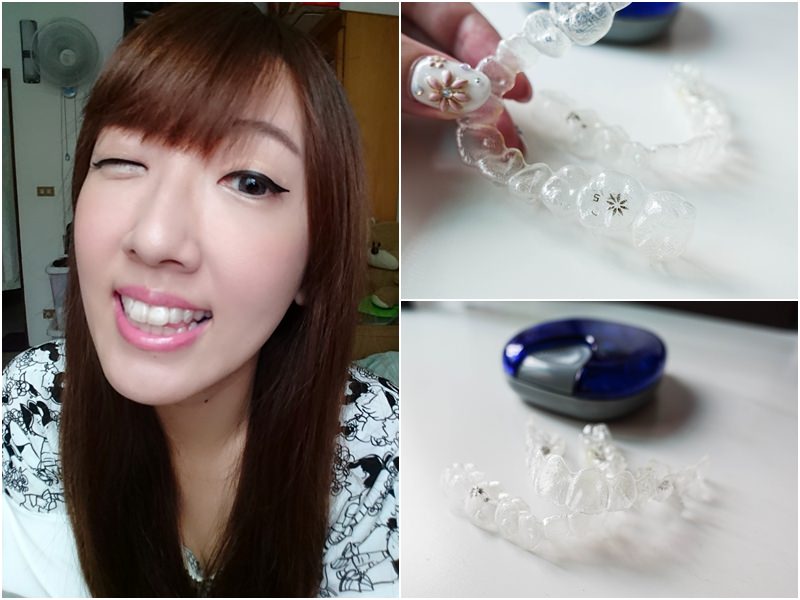 【保養】隱適美 Invisalign。矯正牙齒也能這麼低調！1個月心得分享