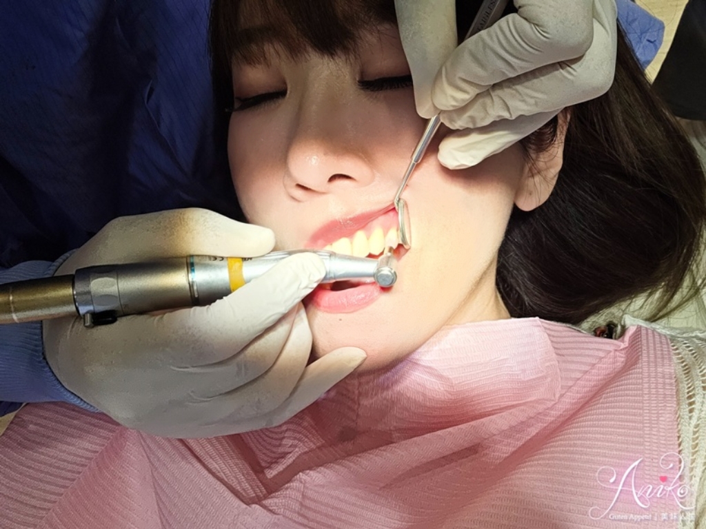 【新北牙醫】林口牙醫推薦!巧益牙醫診所專業植牙價格透明,11年保固的安心選擇 林口牙醫推薦