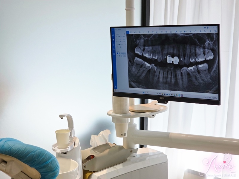 【新北牙醫】林口牙醫推薦!巧益牙醫診所專業植牙價格透明,11年保固的安心選擇 林口牙醫推薦